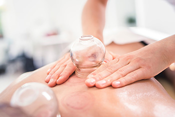 cupping